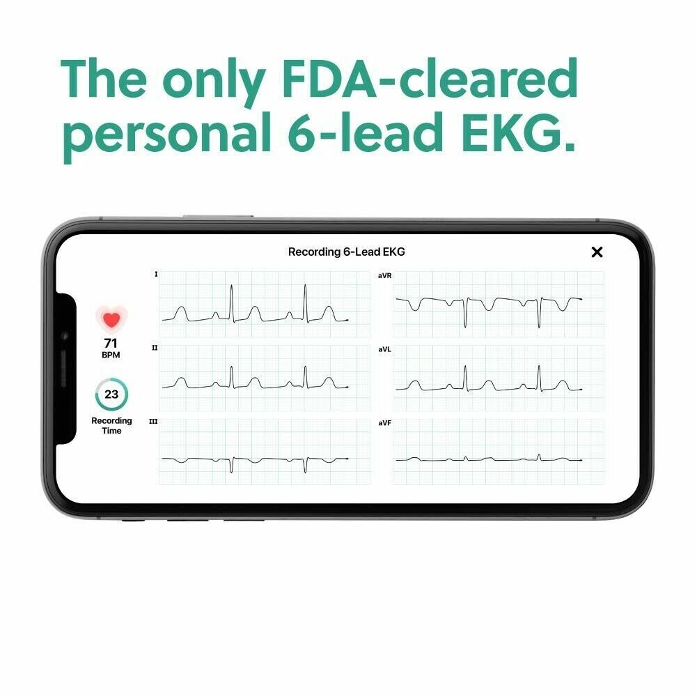 AliveCor KardiaMobile 6L Wireless 6-Lead EKG Smartphone Detects AFib or Normal