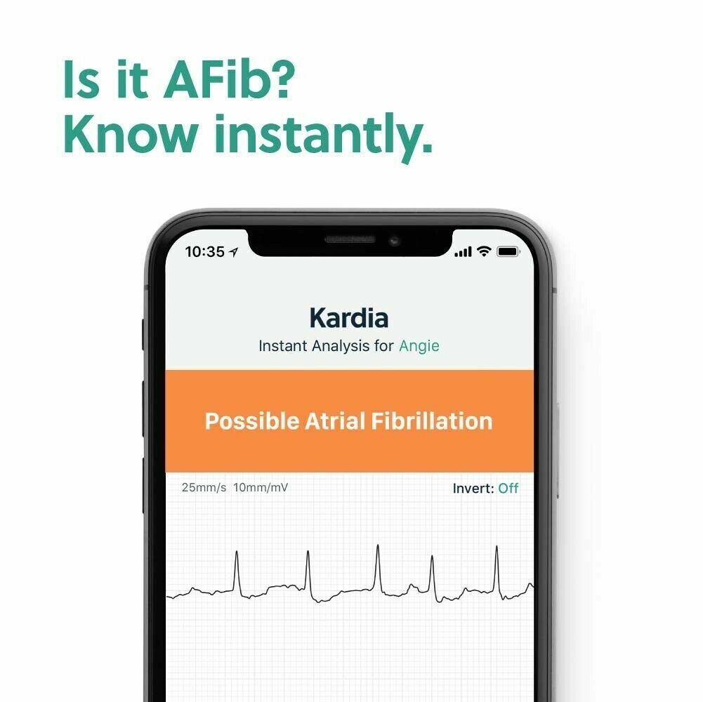 AliveCor KardiaMobile 6L Wireless 6-Lead EKG Smartphone Detects AFib or Normal